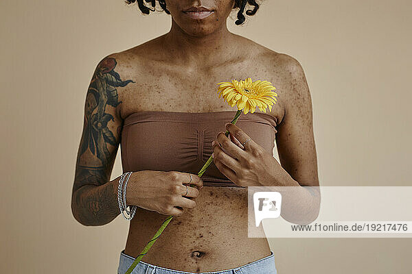 Woman with acne scars holding yellow flower against brown background