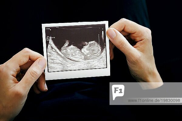 Symbol photo: Staged photo on the subject of miscarriage. A woman holds the ultrasound image of an unborn child in her hands. Berlin  22/08/2023
