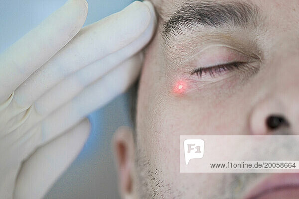 Man Receiving Laser Treatment on Face