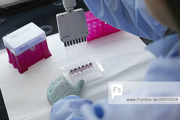 Tools and containers in a medical lab  work being done with pipette and samples