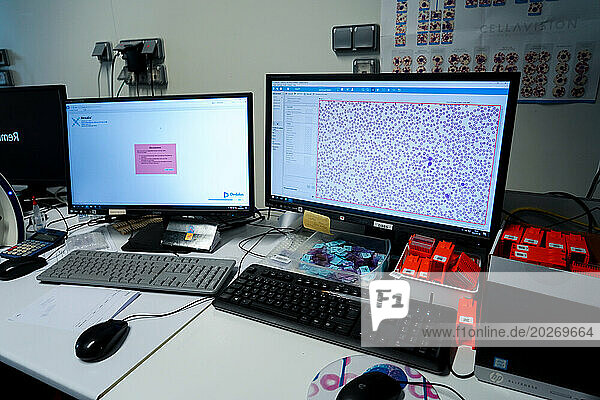 Technical platform of the Inovie 34 laboratory . Digitized optical microscope for the interpretation of blood smears.