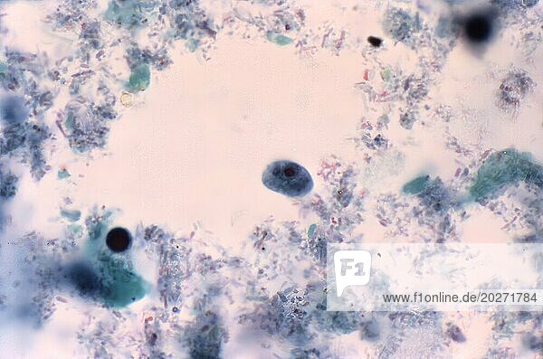 This photomicrograph of a trichrome-stained specimen revealed the presence of a parasitic trophozoite  Iodamoeba butschlii (buetschlii)  which contained inconspicuous achromatic granules in its cytoplasm. CDC/Dr Mae Melvin 1977