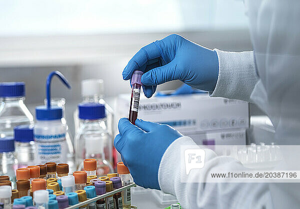 Scientist holding blood sample tube in laboratory