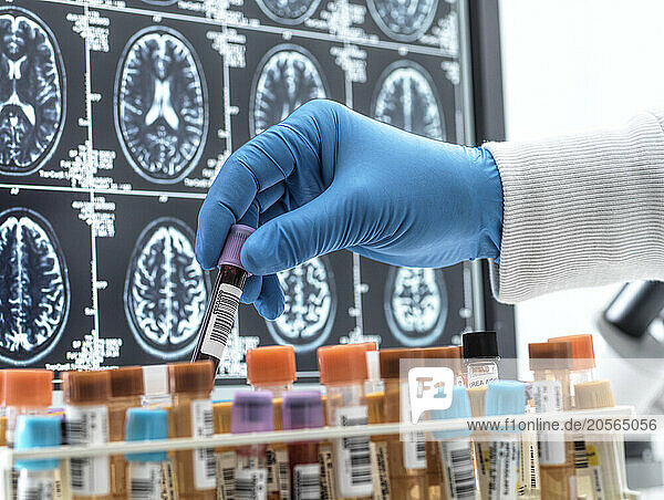 Hand of scientist removing blood sample in laboratory