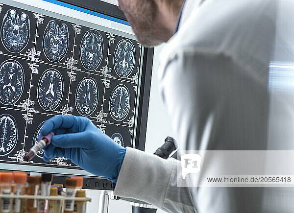 Scientist removing medical sample and checking MRI report in hospital