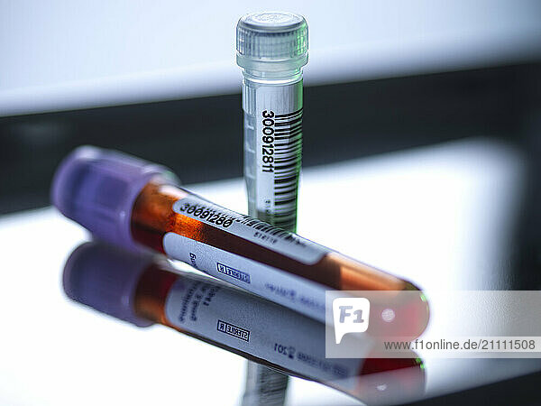 Blood vials and DNA samples used for medical testing and research.