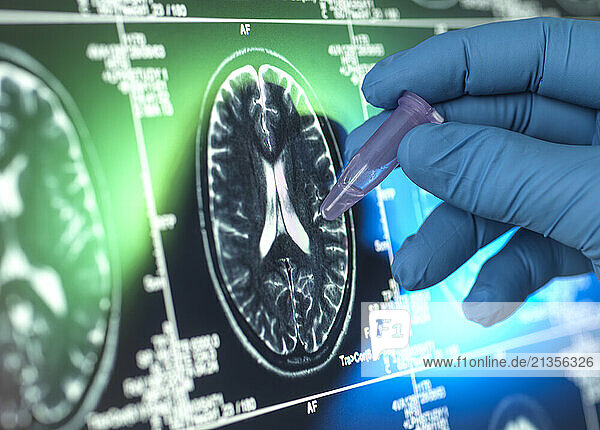 Hand of scientist wearing surgical glove holding vial and examining MRI brain scan