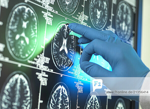 Hand of scientist wearing surgical glove examining MRI scan of patient