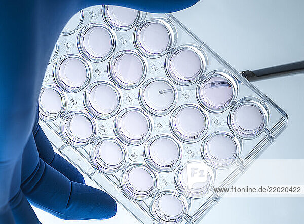 Biomedicine  Scientist preparing cells in growth medium in the lab