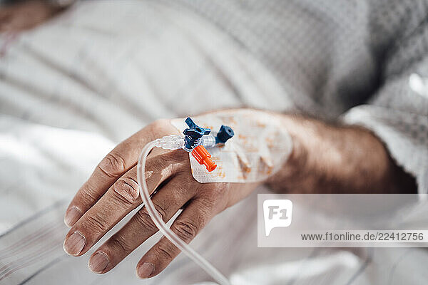 Close-up of a patient s hand with an IV drip in a hospital setting